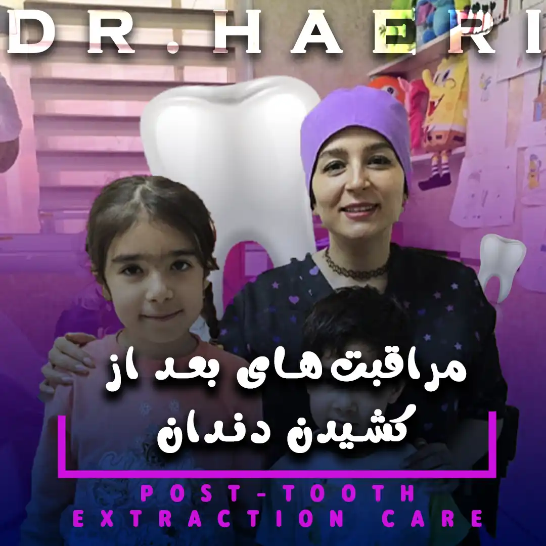 مراقبت‌های بعد از کشیدن دندان