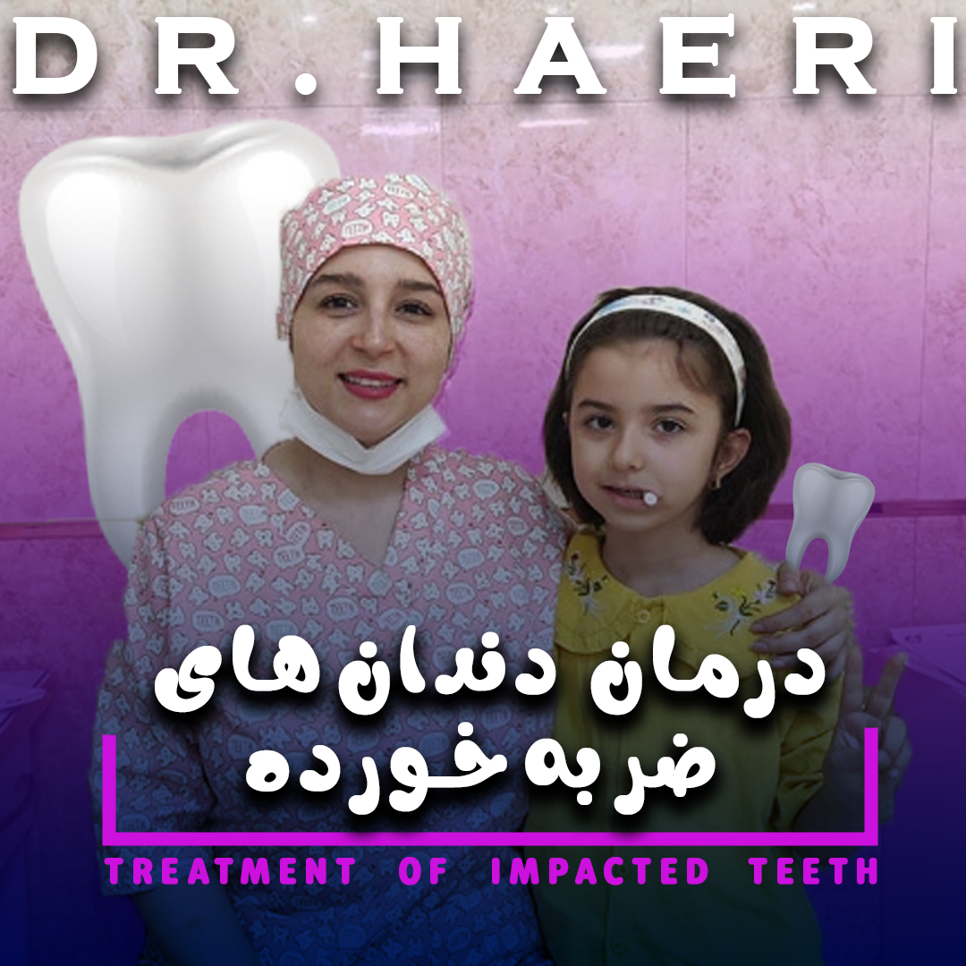درمان دندان‌های ضربه‌خورده