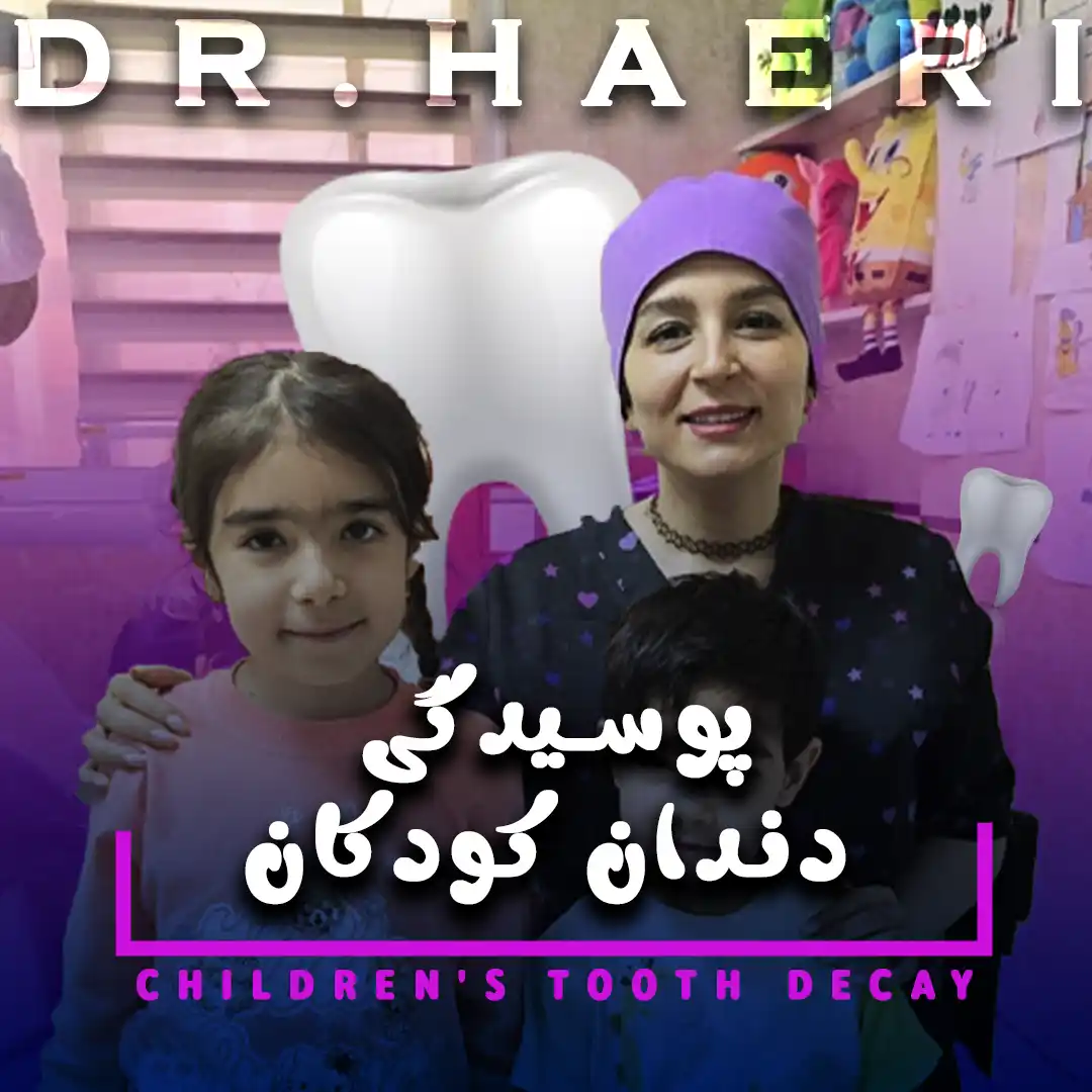 پوسیدگی دندان کودکان