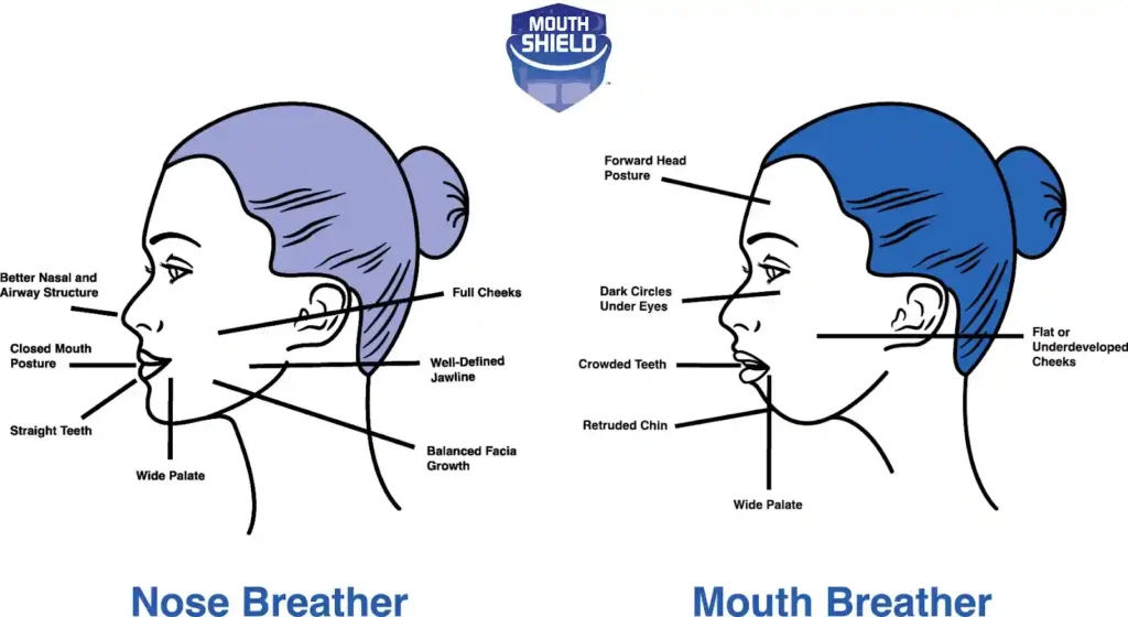 مقایسه تنفس بینی و خوابیدن با دهان باز