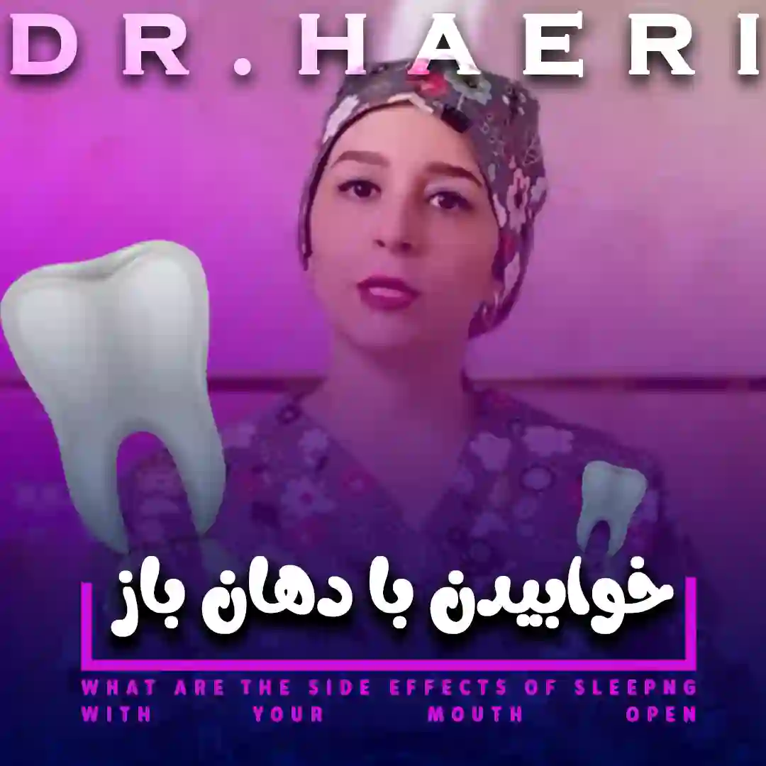 خوابیدن با دهان باز
