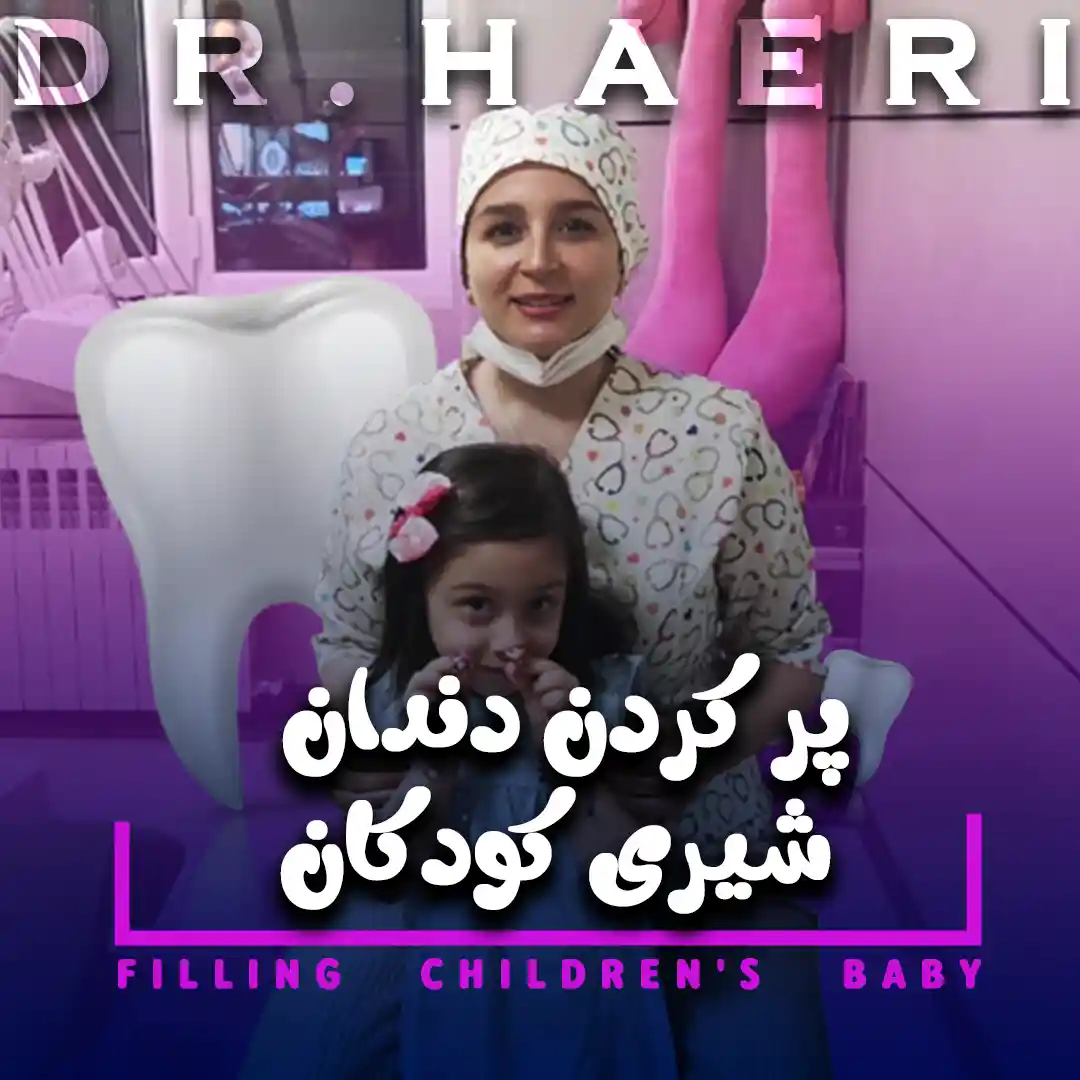 پر کردن دندان شیری کودکان